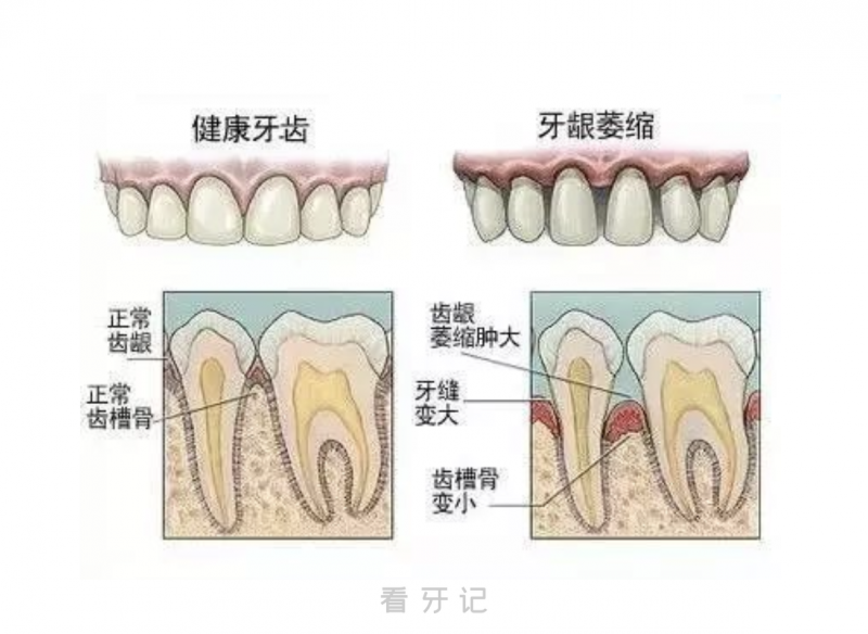 牙缝大漏财是不是迷信？