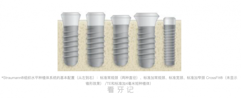 ITI种植牙和士卓曼种植牙有什么区别？