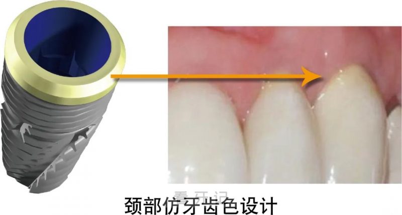 百丹特Biodenta 种植体 (TP)介绍