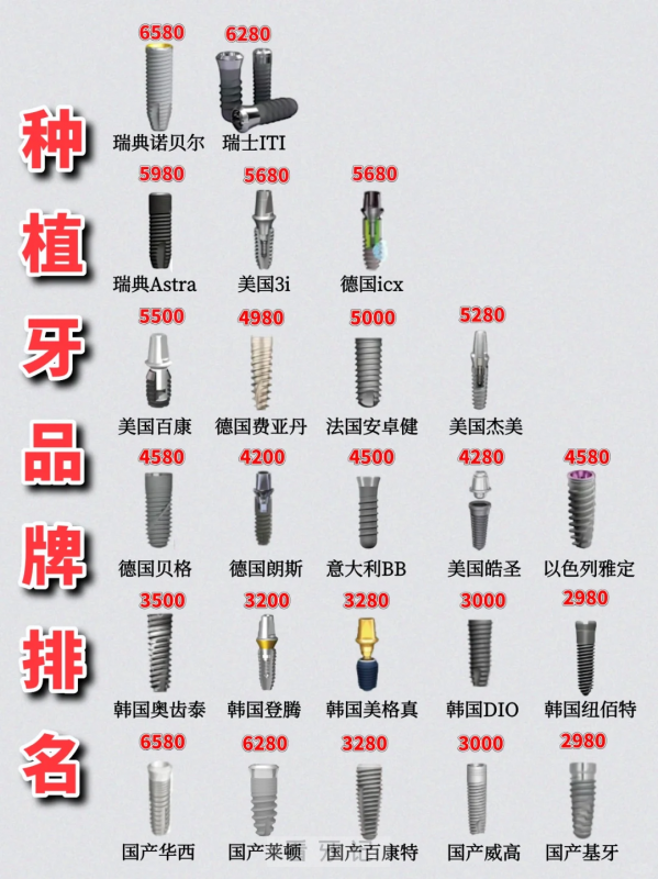 种植牙品牌名单价格大全及TOP榜单（含进口国产）