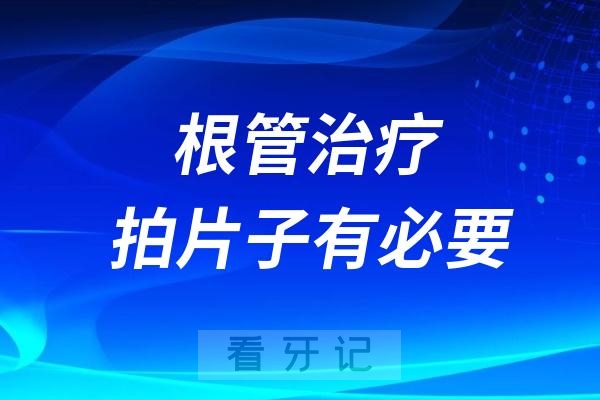 根管治疗要拍片子有没有必要？可以不拍吗？