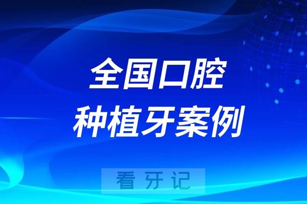 全国口腔种植牙案例医生资料查询系统