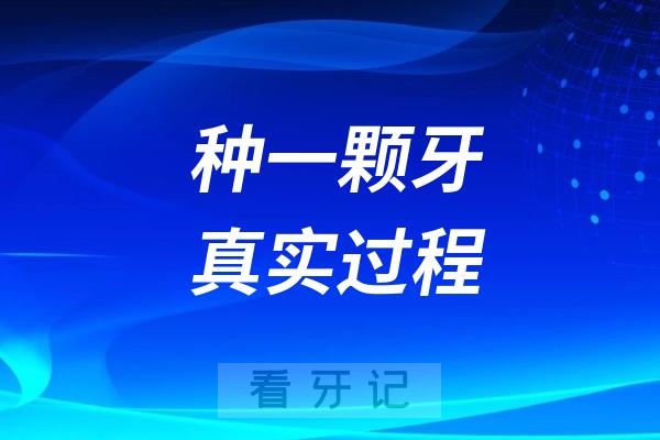 分享去口腔医院种一颗牙的真实过程