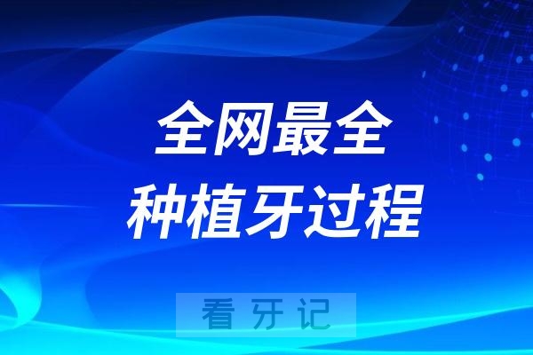 全网最全的种植牙过程整理2024版（种植牙详细种植流程）