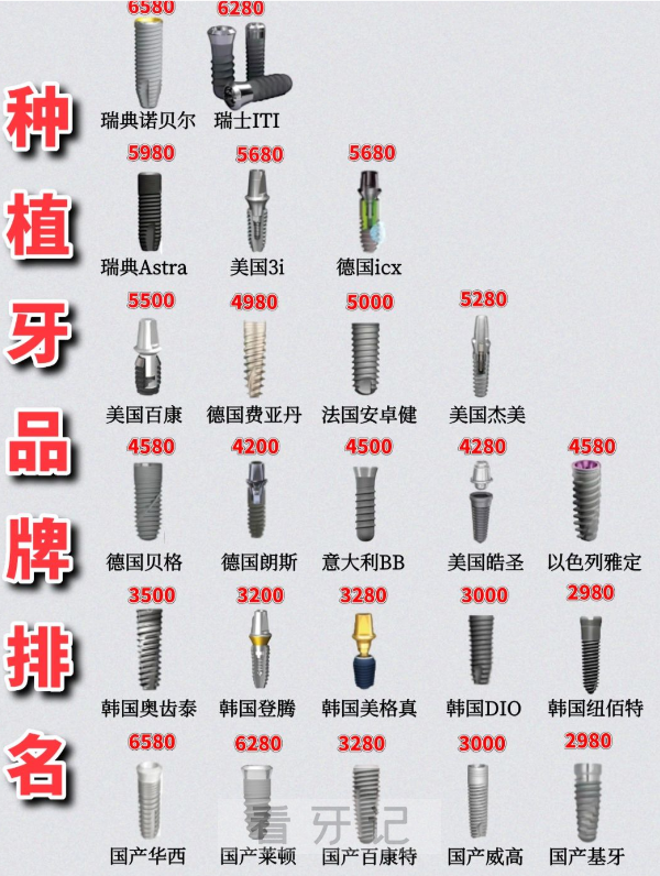 哪个品牌种植体性价比高？全国十大靠谱种植牙品牌前十名单及价格表整理